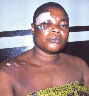 woman beaten missing manhood lagos