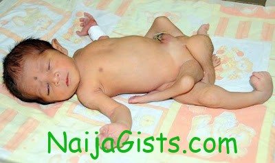 baby born with six legs in pakistan