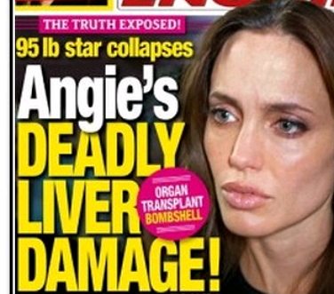 angelina jolie liver disease