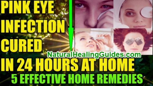 how to cure eye infection in 24 hours