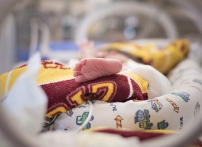 premature baby with jaundice seized parents home